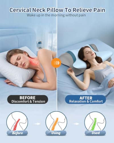 Blue Cervical Pillow for Neck Pain Relief - Ergonomic Memory Foam Support