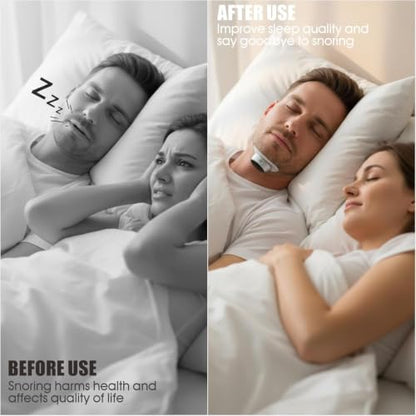 Sleep Ease Pro 4.0 Portable Anti-Snoring Device with 10 Patches - 3 Speed Settings