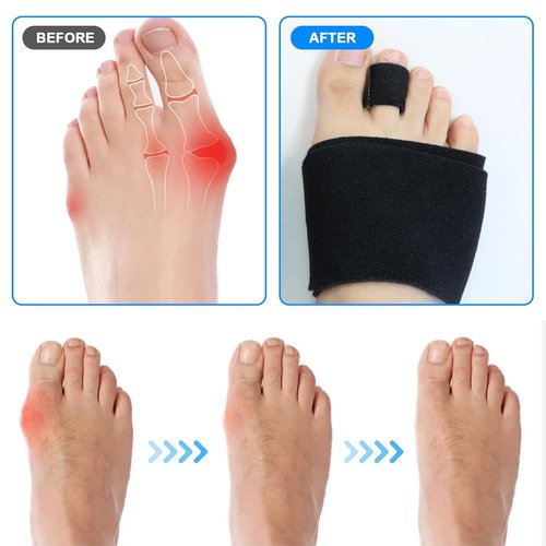 Hammer Toe Straightener Corrector for Women and Men Toe Straighteners