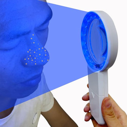 Cordless Wood's Lamp Ringworm Detection Light-Skin Testing-Esthetician-Veterinaria-5x Magnifying Wood Lamp Black Light-16 LED-Battery Powered (Portable Woods Lamp)