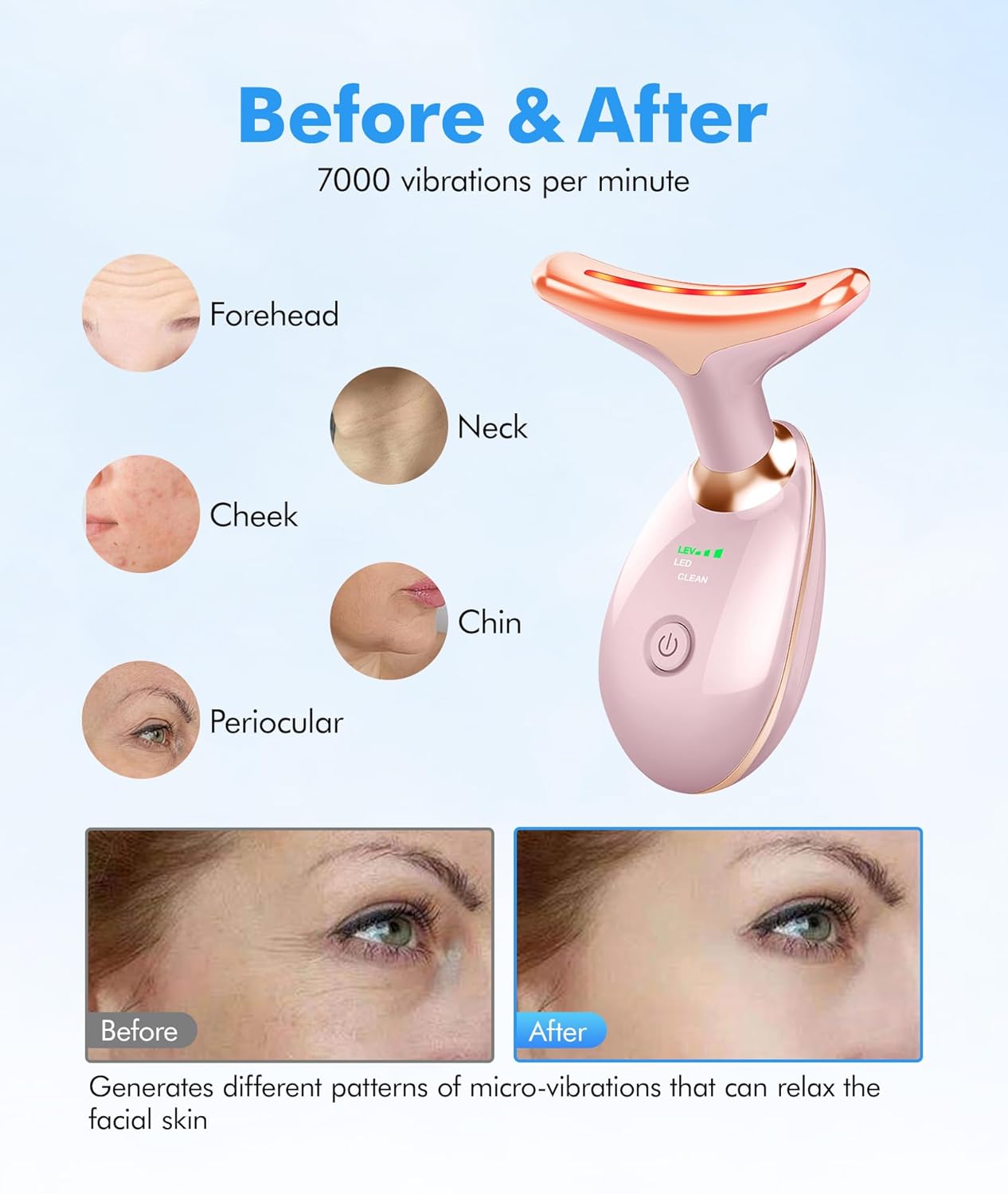 Skiennix Red Light Therapy Face Massager - 7 Color Tool for Wrinkles & Double Chin | Glossy Pink