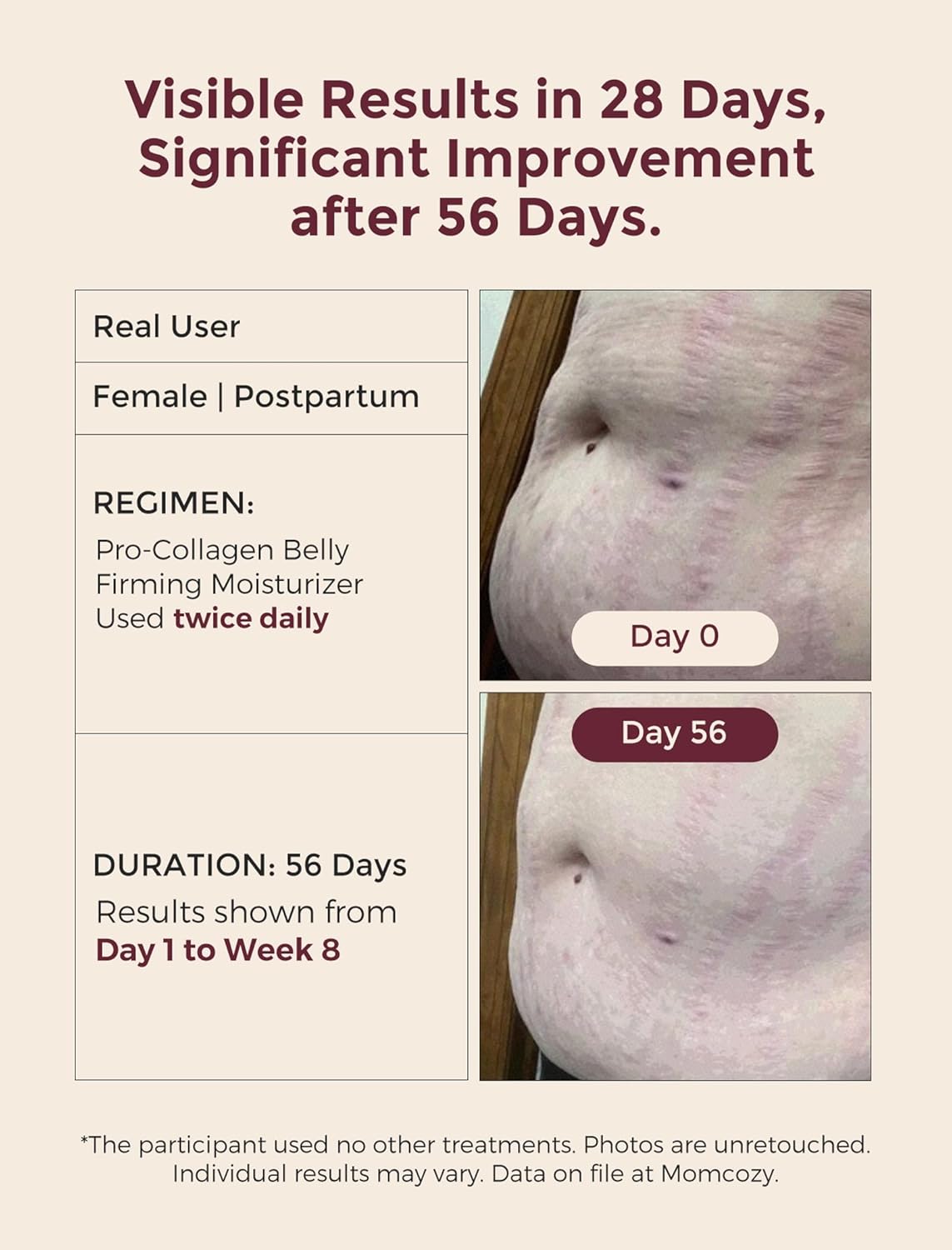 Momcozy Stretch Mark Cream - Pro-Collagen Belly Firming Moisturizer with Peptides | 5.29 oz (150g)