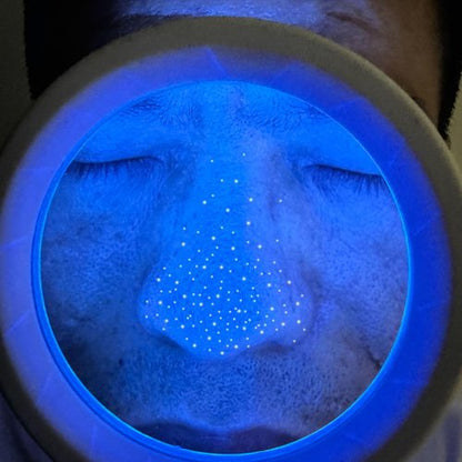 Cordless Wood's Lamp Ringworm Detection Light-Skin Testing-Esthetician-Veterinaria-5x Magnifying Wood Lamp Black Light-16 LED-Battery Powered (Portable Woods Lamp)