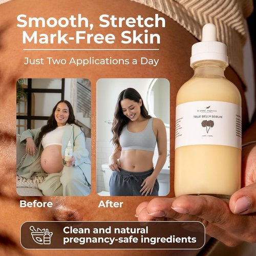 8 Sheep True Belly Serum - Pregnancy-Safe Skin Care Oil with Hyaluronic Acid & Centella Asiatica | 4 FL OZ
