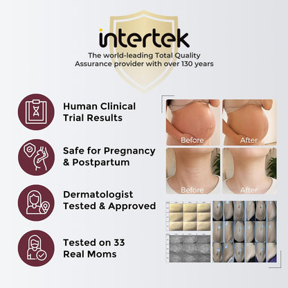 Momcozy Stretch Mark Prevention Cream - Travel Size Belly Moisturizer with Peptides & Shea Butter | 1.06 oz (30g)