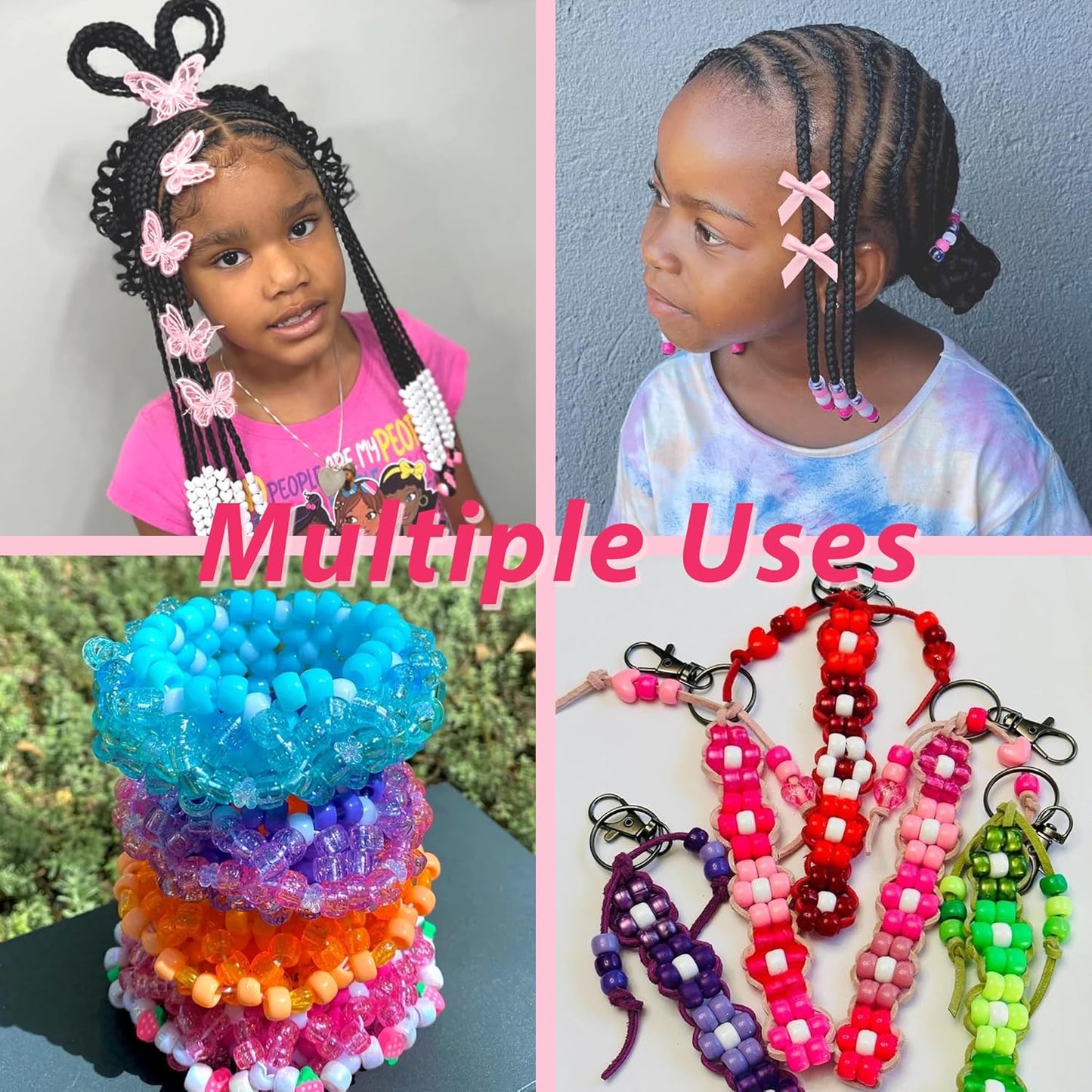Skiennix 100PCS Small Pink Hair Beads - Gradient Acrylic Bows for Braids & Dreadlocks | Cute Accessories for Women & Girls
