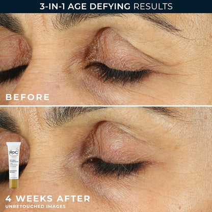 RoC Retinol Correxion Duo Set - Anti-Aging Night Face Cream & Under Eye Cream for Dark Circles